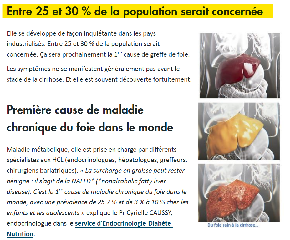 Statistiques sur les maladies du foie dans la population